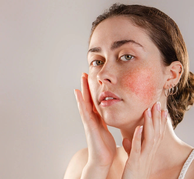 Sensitive Skin