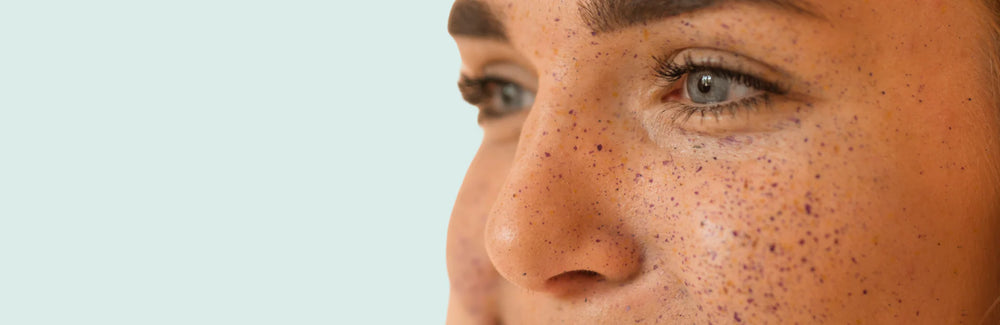 Sensitive Skin