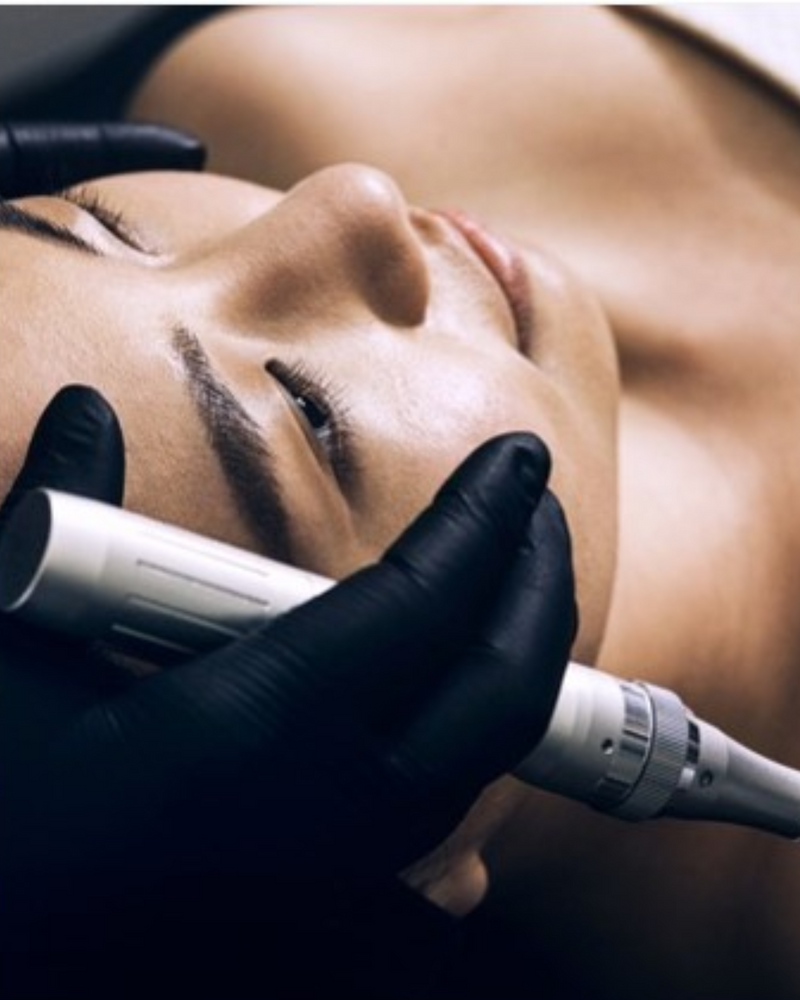 MIcroneedling